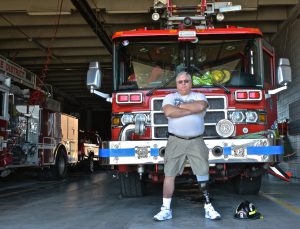 The Importance of Going to Your Prosthetist for a Checkup