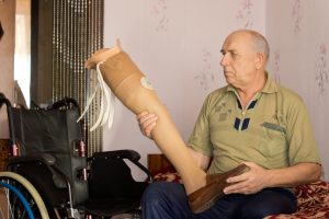 How Often Should You Replace Your Prosthesis?